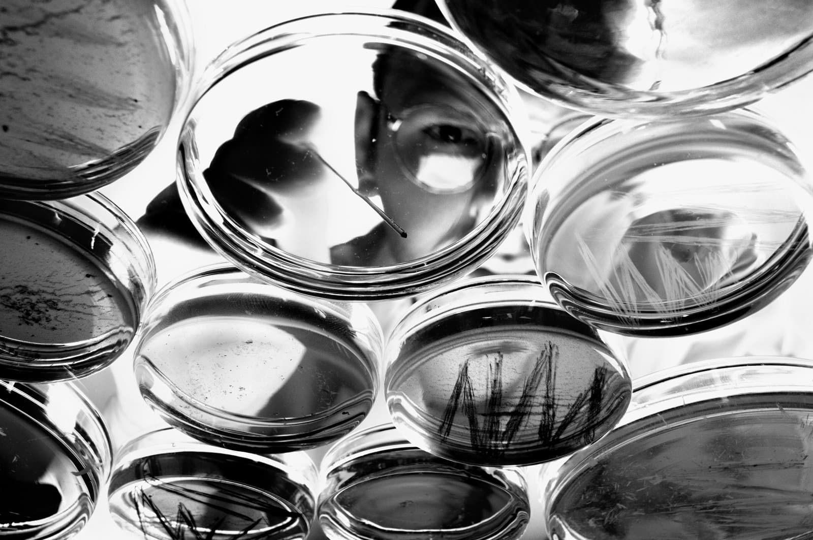 Researcher examining cultures in petri dishes, close-up, low angle view